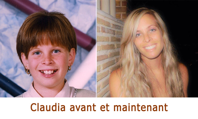 Apparence avant et maintenant